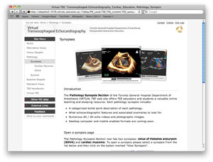 screen capture of TEE pathology web page